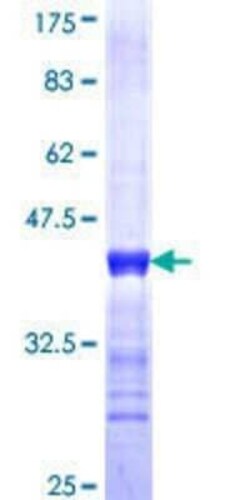 Novus Biologicals Recombinant Human C-myc promoter-binding protein GST (N-Term) Protein 10 &mu;g | Buy Online | Novus Biologicals&trade; | Fisher Scientific