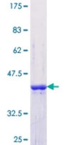 Novus Biologicals Recombinant Human SF3B4 GST (N-Term) Protein 10 &mu;g | Buy Online | Novus Biologicals&trade; | Fisher Scientific