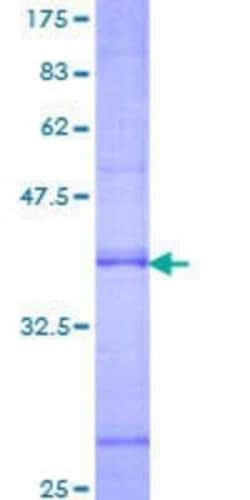 Novus Biologicals Recombinant Human RAMP2 GST (N-Term) Protein 25 &mu;g | Buy Online | Novus Biologicals&trade; | Fisher Scientific