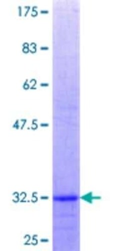 Novus Biologicals Recombinant Human ZMPSTE24 GST (N-Term) Protein 25 &mu;g | Buy Online | Novus Biologicals&trade; | Fisher Scientific
