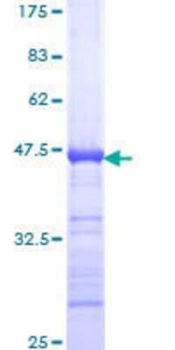 Novus Biologicals Recombinant Human AKAP95/AKAP8 GST (N-Term) Protein 10 &mu;g | Buy Online | Novus Biologicals&trade; | Fisher Scientific