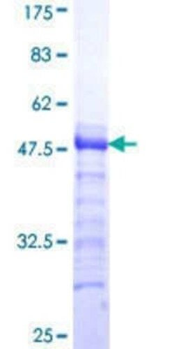 Novus Biologicals Recombinant Human SA1 GST (N-Term) Protein 10 &mu;g | Buy Online | Novus Biologicals&trade; | Fisher Scientific
