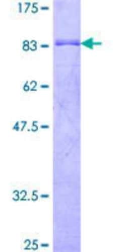 Novus Biologicals Recombinant Human EFS GST (N-Term) Protein 10 &mu;g | Buy Online | Novus Biologicals&trade; | Fisher Scientific