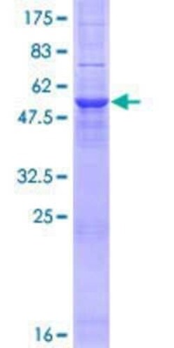 Novus Biologicals Recombinant Human Sigma-1 R/OPRS1 GST (N-Term) Protein 2 &mu;g | Buy Online | Novus Biologicals&trade; | Fisher Scientific