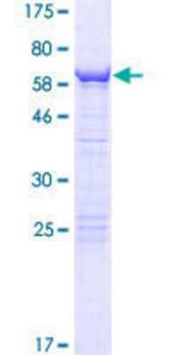 Novus Biologicals Recombinant Human SDCCAG10 GST (N-Term) Protein 10 &mu;g | Buy Online | Novus Biologicals&trade; | Fisher Scientific