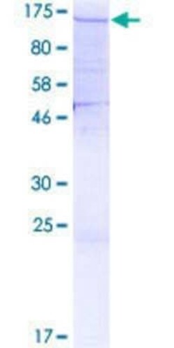 Novus Biologicals Recombinant Human SF3A1 GST (N-Term) Protein 2 &mu;g | Buy Online | Novus Biologicals&trade; | Fisher Scientific