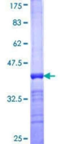 Novus Biologicals Recombinant Human SF3A1 GST (N-Term) Protein 25 &mu;g | Buy Online | Novus Biologicals&trade; | Fisher Scientific