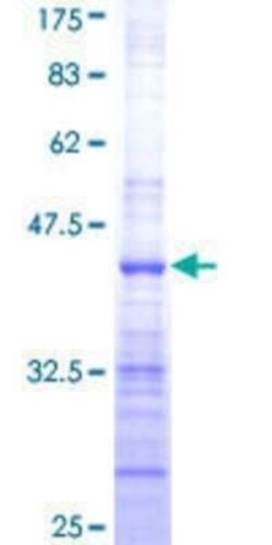 Novus Biologicals Recombinant Human TRAIP GST (N-Term) Protein 25 &mu;g | Buy Online | Novus Biologicals&trade; | Fisher Scientific