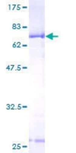 Novus Biologicals Recombinant Human BCKDK GST (N-Term) Protein 10 &mu;g | Buy Online | Novus Biologicals&trade; | Fisher Scientific