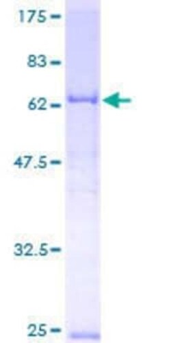 Novus Biologicals Recombinant Human BCKDK GST (N-Term) Protein 2 &mu;g | Buy Online | Novus Biologicals&trade; | Fisher Scientific