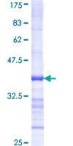 Novus Biologicals Recombinant Human BCKDK GST (N-Term) Protein 25 &mu;g | Buy Online | Novus Biologicals&trade; | Fisher Scientific