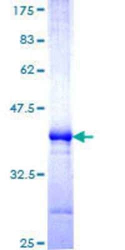 Novus Biologicals Recombinant Human MARCH6 GST (N-Term) Protein 25 &mu;g | Buy Online | Novus Biologicals&trade; | Fisher Scientific