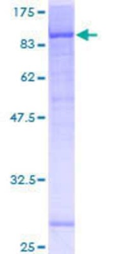 Novus Biologicals Recombinant Human katanin-p80 GST (N-Term) Protein 10 &mu;g | Buy Online | Novus Biologicals&trade; | Fisher Scientific