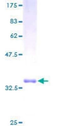 Novus Biologicals Recombinant Human DLEU1 GST (N-Term) Protein 10 &mu;g | Buy Online | Novus Biologicals&trade; | Fisher Scientific