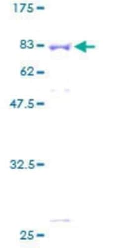 Novus Biologicals Recombinant Human APBB3 GST (N-Term) Protein 2 &mu;g | Buy Online | Novus Biologicals&trade; | Fisher Scientific