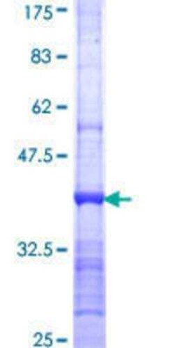 Novus Biologicals Recombinant Human ZNF267 GST (N-Term) Protein 25 &mu;g | Buy Online | Novus Biologicals&trade; | Fisher Scientific