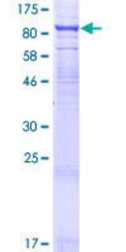 Novus Biologicals Recombinant Human TCIRG1 GST (N-Term) Protein 10 &mu;g | Buy Online | Novus Biologicals&trade; | Fisher Scientific