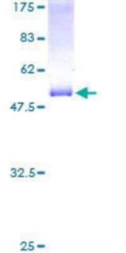 Novus Biologicals Recombinant Human RTN3 GST (N-Term) Protein 2 &mu;g | Buy Online | Novus Biologicals&trade; | Fisher Scientific