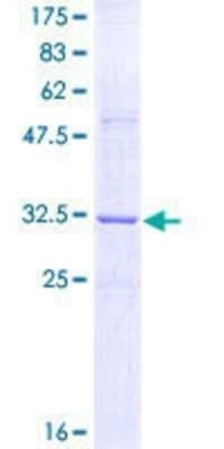 Novus Biologicals Recombinant Human RTN3 GST (N-Term) Protein 10 &mu;g | Buy Online | Novus Biologicals&trade; | Fisher Scientific