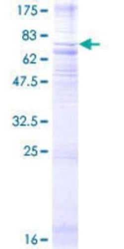 Novus Biologicals Recombinant Human Neuromedin UR1/NMUR1 GST (N-Term) Protein 2 &mu;g | Buy Online | Novus Biologicals&trade; | Fisher Scientific
