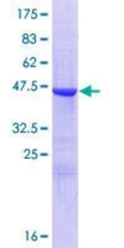 Novus Biologicals Recombinant Human CNPY2 GST (N-Term) Protein 10 &mu;g | Buy Online | Novus Biologicals&trade; | Fisher Scientific