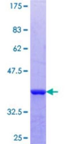 Novus Biologicals Recombinant Human CNPY2 GST (N-Term) Protein 10 &mu;g | Buy Online | Novus Biologicals&trade; | Fisher Scientific