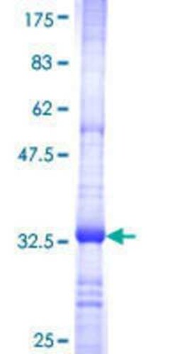 Novus Biologicals Recombinant Human B3GNT3 GST (N-Term) Protein 10 &mu;g | Buy Online | Novus Biologicals&trade; | Fisher Scientific