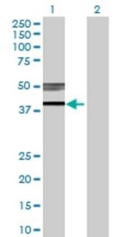Novus Biologicals B3GNT3 293T Cell Transient Overexpression Lysate 0.1 mL | Buy Online | Novus Biologicals&trade; | Fisher Scientific