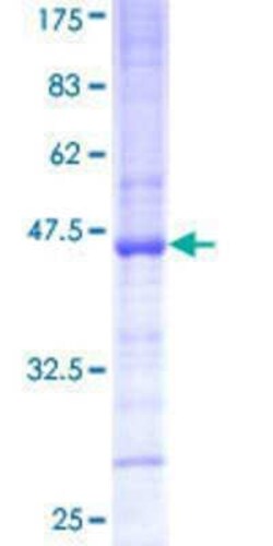 Novus Biologicals Recombinant Human PCGF3 GST (N-Term) Protein 25 &mu;g | Buy Online | Novus Biologicals&trade; | Fisher Scientific
