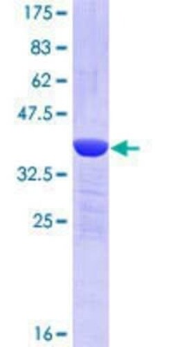 Novus Biologicals Recombinant Human TFG GST (N-Term) Protein 10 &mu;g | Buy Online | Novus Biologicals&trade; | Fisher Scientific