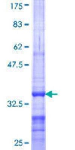 Novus Biologicals Recombinant Human ABCA10 GST (N-Term) Protein 10 &mu;g | Buy Online | Novus Biologicals&trade; | Fisher Scientific