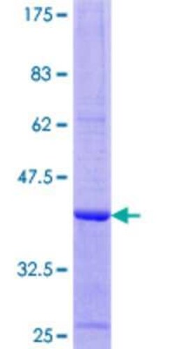 Novus Biologicals Recombinant Human WARS2 GST (N-Term) Protein 10 &mu;g | Buy Online | Novus Biologicals&trade; | Fisher Scientific