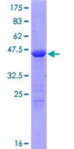 Novus Biologicals Recombinant Human Nucleoplasmin-3 GST (N-Term) Protein 25 &mu;g | Buy Online | Novus Biologicals&trade; | Fisher Scientific