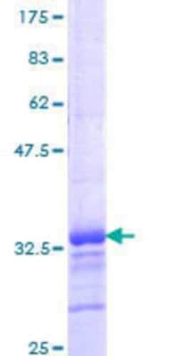 Novus Biologicals Recombinant Human KLF2 GST (N-Term) Protein 10 &mu;g | Buy Online | Novus Biologicals&trade; | Fisher Scientific