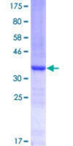 Novus Biologicals Recombinant Human CBARA1 GST (N-Term) Protein 10 &mu;g | Buy Online | Novus Biologicals&trade; | Fisher Scientific