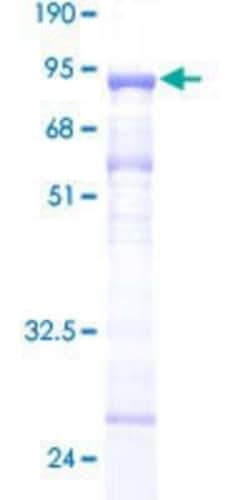 Novus Biologicals Recombinant Human Tubulin alpha-1B GST (N-Term) Protein 25 &mu;g | Buy Online | Novus Biologicals&trade; | Fisher Scientific
