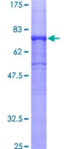 Novus Biologicals Recombinant Human Tubulin alpha-1B GST (N-Term) Protein 25 &mu;g | Buy Online | Novus Biologicals&trade; | Fisher Scientific
