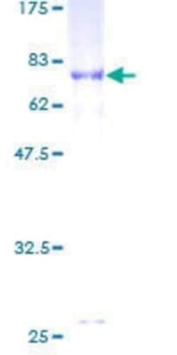 Novus Biologicals Recombinant Human Tubulin Beta 2C GST (N-Term) Protein 10 &mu;g | Buy Online | Novus Biologicals&trade; | Fisher Scientific