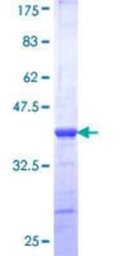 Novus Biologicals Recombinant Human NOD1 GST (N-Term) Protein 10 &mu;g | Buy Online | Novus Biologicals&trade; | Fisher Scientific