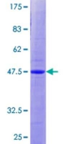 Novus Biologicals Recombinant Human Apc10 GST (N-Term) Protein 2 &mu;g | Buy Online | Novus Biologicals&trade; | Fisher Scientific