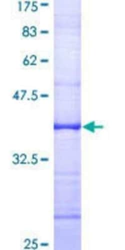 Novus Biologicals Recombinant Human Apc10 GST (N-Term) Protein 10 &mu;g | Buy Online | Novus Biologicals&trade; | Fisher Scientific