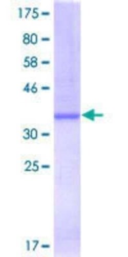 Novus Biologicals Recombinant Human RAPGEF3 GST (N-Term) Protein 25 &mu;g | Buy Online | Novus Biologicals&trade; | Fisher Scientific