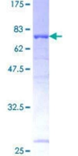 Novus Biologicals Recombinant Human UBAC1 GST (N-Term) Protein 25 &mu;g | Buy Online | Novus Biologicals&trade; | Fisher Scientific
