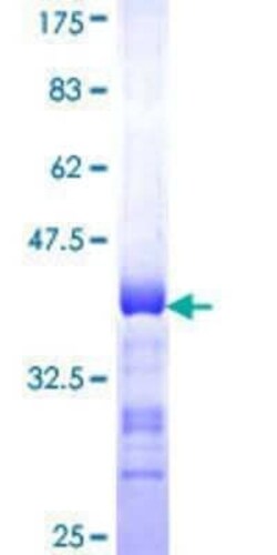 Novus Biologicals Recombinant Human PGRMC2 GST (N-Term) Protein 25 &mu;g | Buy Online | Novus Biologicals&trade; | Fisher Scientific
