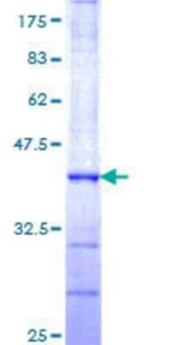 Novus Biologicals Recombinant Human ARIH2 GST (N-Term) Protein 25 &mu;g | Buy Online | Novus Biologicals&trade; | Fisher Scientific