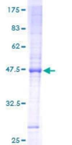 Novus Biologicals Recombinant Human TIM23 GST (N-Term) Protein 10 &mu;g | Buy Online | Novus Biologicals&trade; | Fisher Scientific
