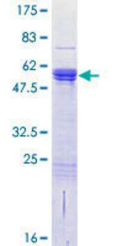Novus Biologicals Recombinant Human CDC42EP2 GST (N-Term) Protein 25 &mu;g | Buy Online | Novus Biologicals&trade; | Fisher Scientific