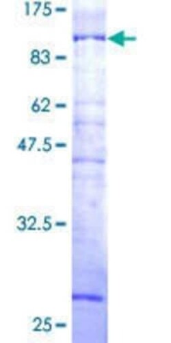 Novus Biologicals Recombinant Human N4BP2L2 GST (N-Term) Protein 25 &mu;g | Buy Online | Novus Biologicals&trade; | Fisher Scientific