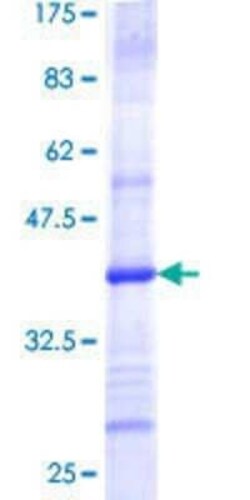 Novus Biologicals Recombinant Human TOMM40 GST (N-Term) Protein 2 &mu;g | Buy Online | Novus Biologicals&trade; | Fisher Scientific