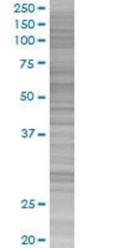 Novus Biologicals Zinc transporter 9 293T Cell Transient Overexpression Lysate 0.1 mL | Buy Online | Novus Biologicals&trade; | Fisher Scientific
